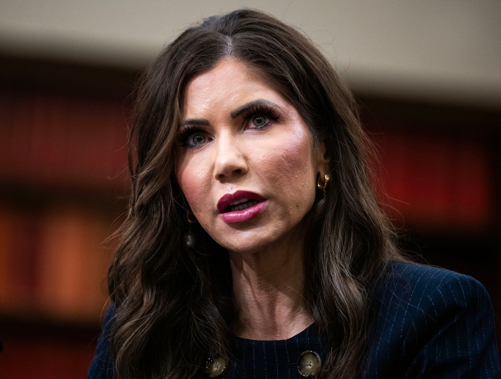 Allergic Swelling Leaves Kristi Noem’s Face Completely Recognizable