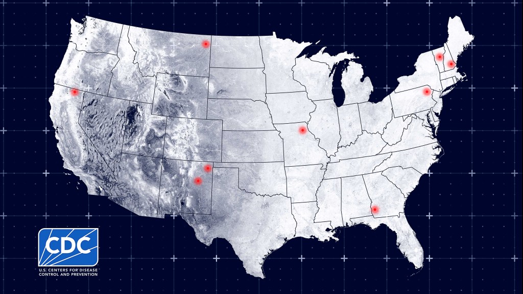 CDC Figures It Easier To Start Tracking People Without Measles